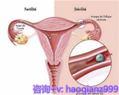 四川省人民医院擅长解决不孕不育哪些方面的问题？