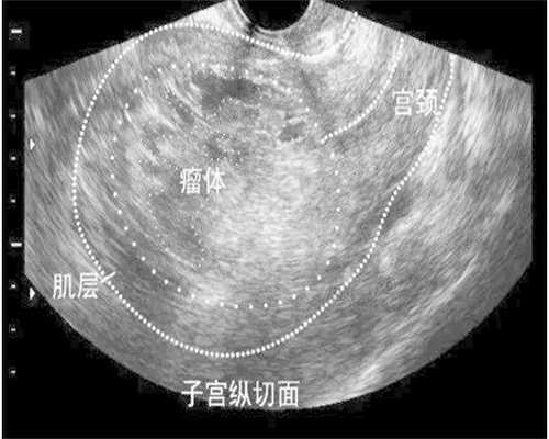 孩子抗拒分床？5个温和引导技巧助其独立安睡