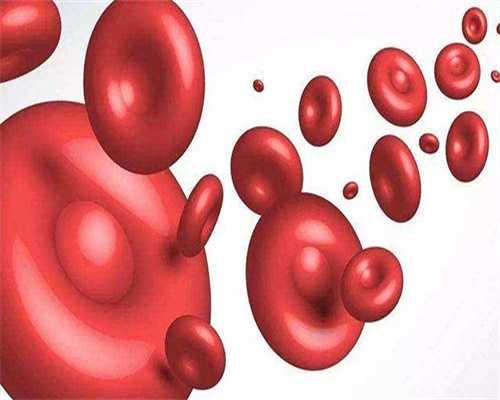 孕妇静脉曲张怎么办？