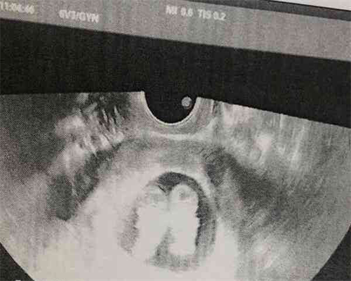 婴幼儿视力发育：彩色玩具使用的专家建议