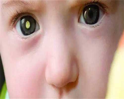 长沙助孕揭秘：二宝降临，如何安抚老大情绪，巧妙应对多孩家庭挑战